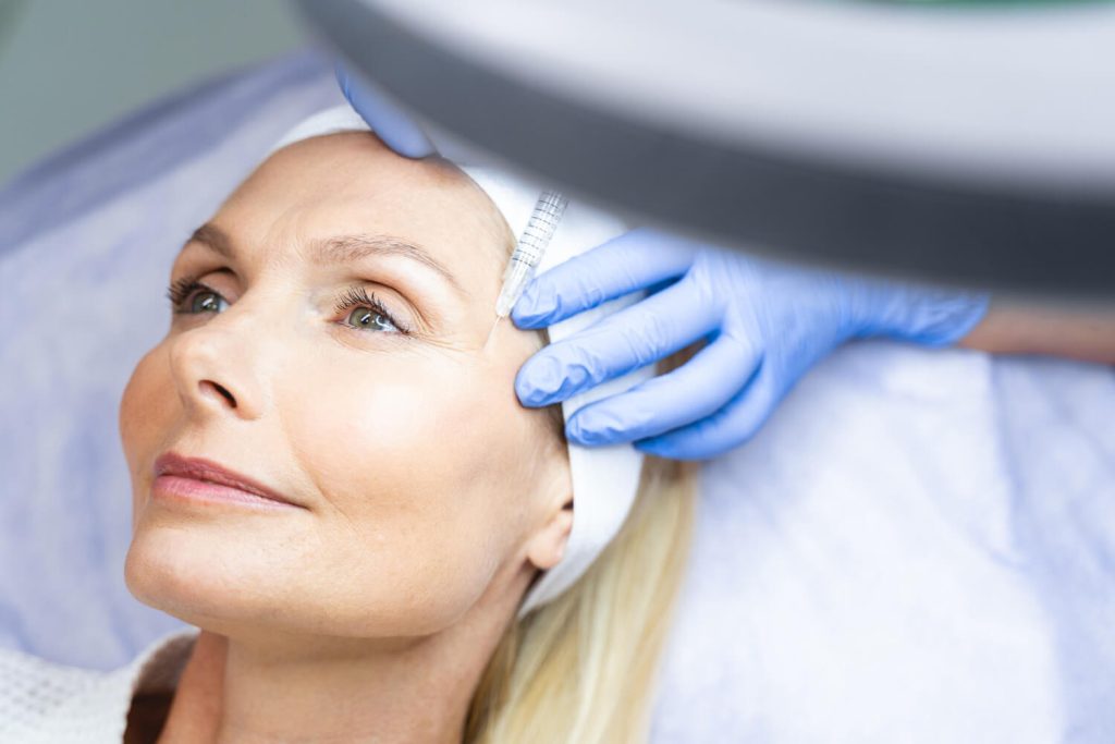 face lift with local anesthesia