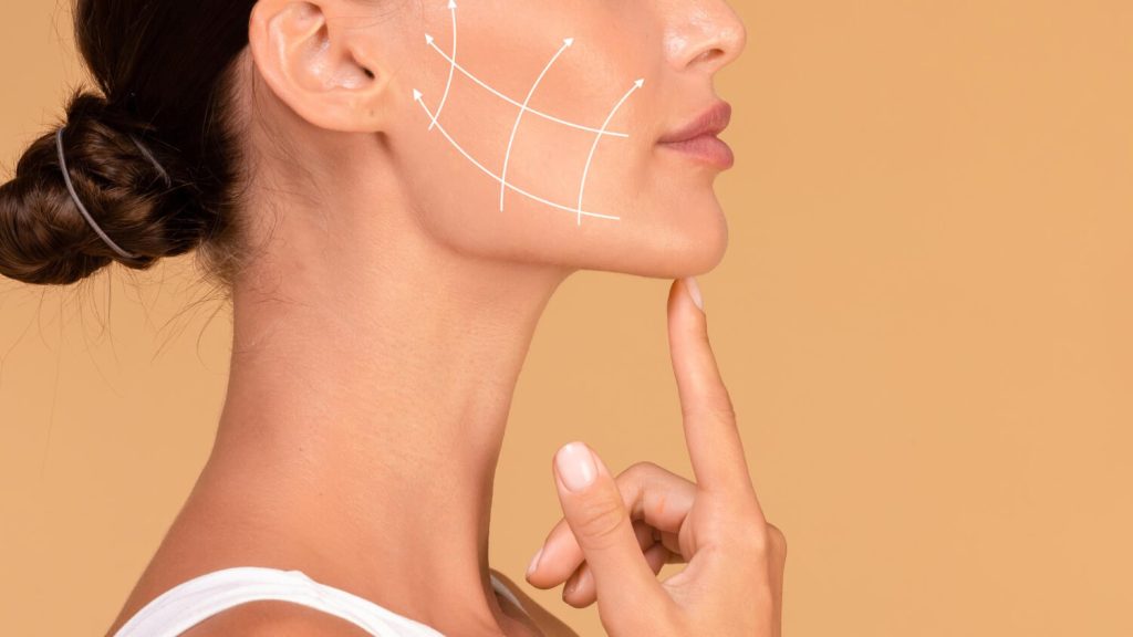 facelift results