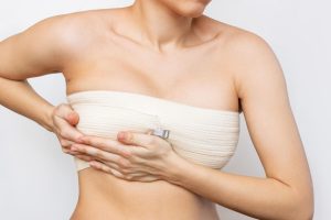 scars post-breast reduction