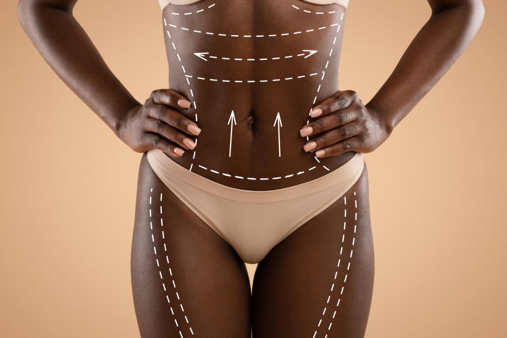 Combining Cosmetic Surgeries