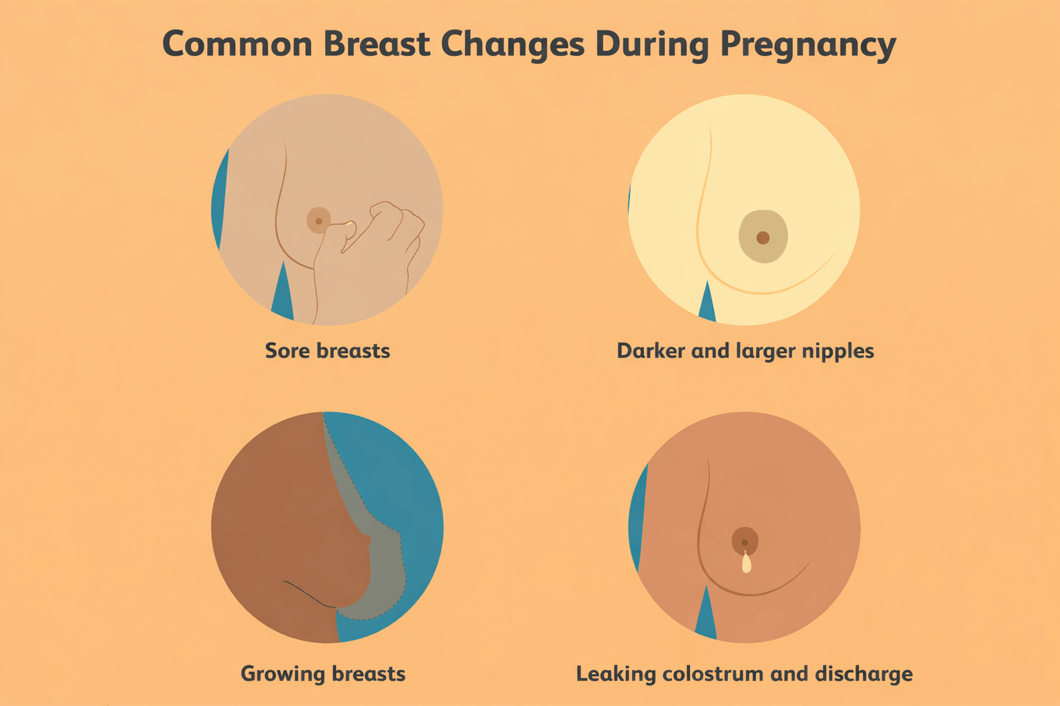 commom breast changes during pregnancy