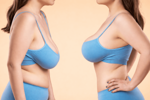 Fix Breast and Nipple Concerns After Pregnancy